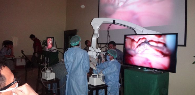 Operasi Chorea-Distonia pertama di indonesia dengan stereotactic neurosurgery